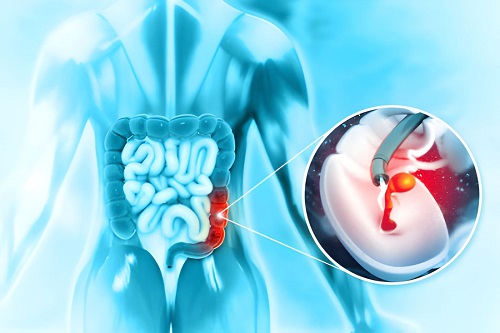 Best Doctor for Endoscopy in Byculla